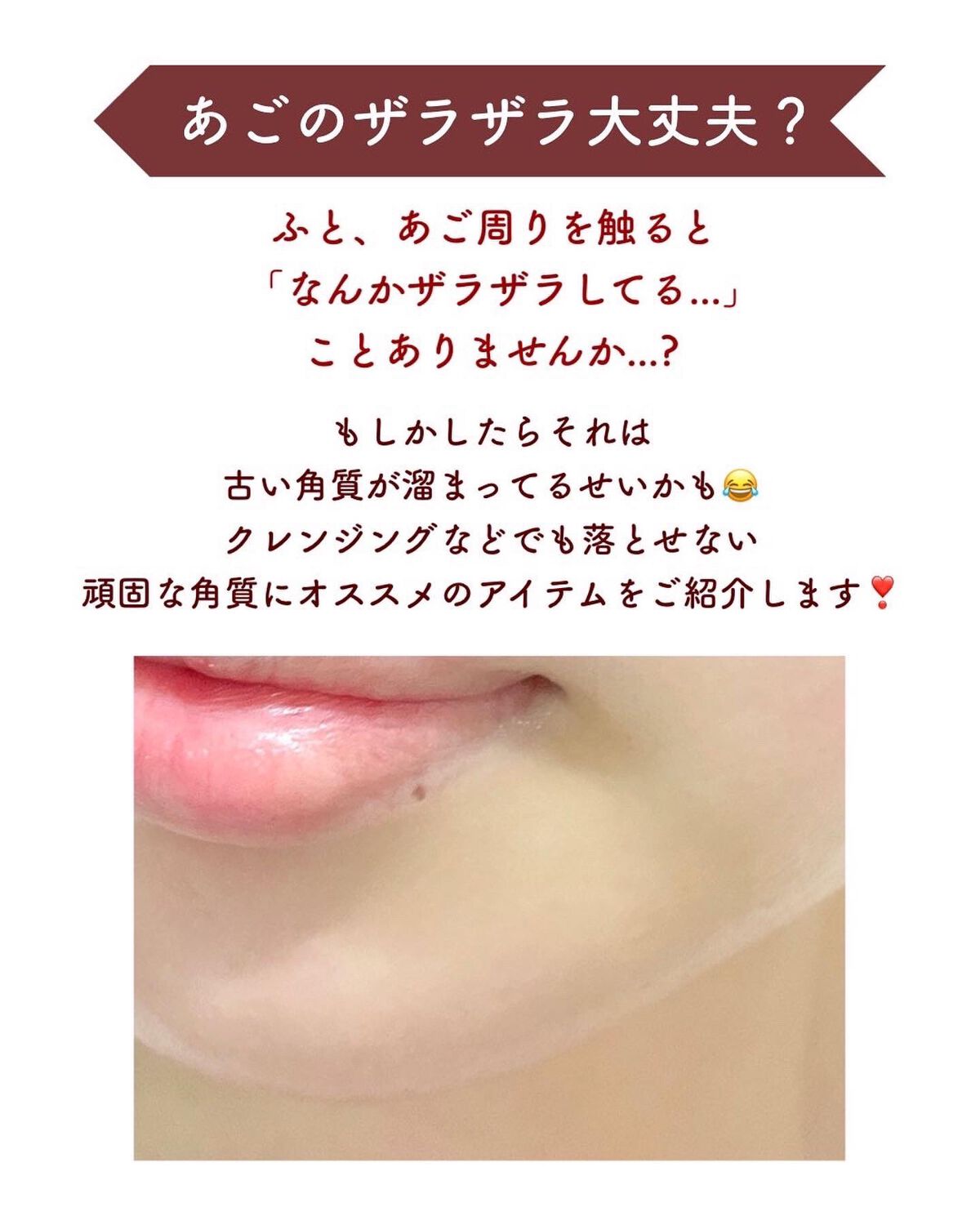 アクアピールクリア/TBC/美顔器・マッサージを使ったクチコミ(2枚目)