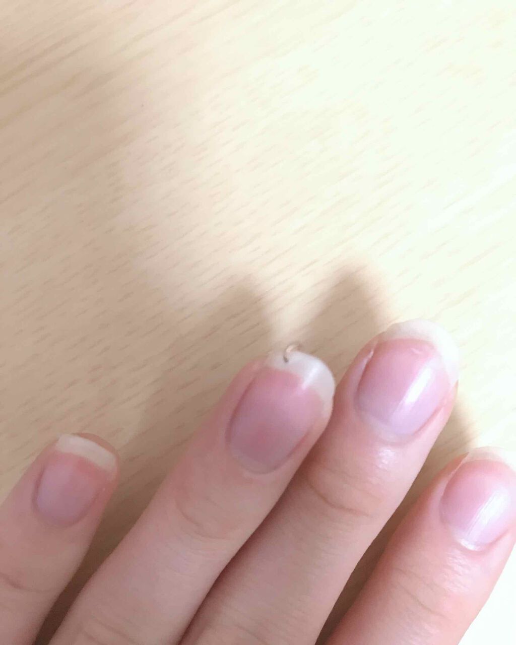 ãããð on LIPS ã(ïŸâœïŸ)/ïŸïŸïŸïŸä»åã¯çªãã¢ã¹ã玹ä»ããŸãïŒè³ã®ãã¢ã¹ã..ãïŒ2æç®ïŒ