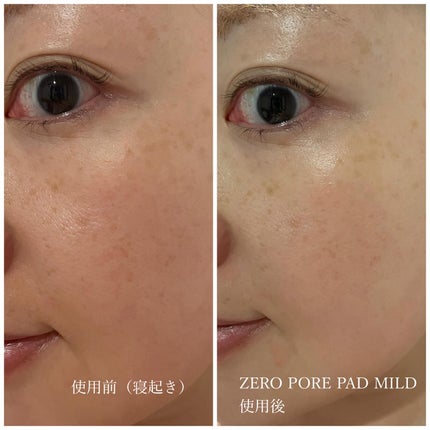 ゼロ毛穴パッド 2.0/MEDICUBE/トナーパッドを使ったクチコミ(8枚目)