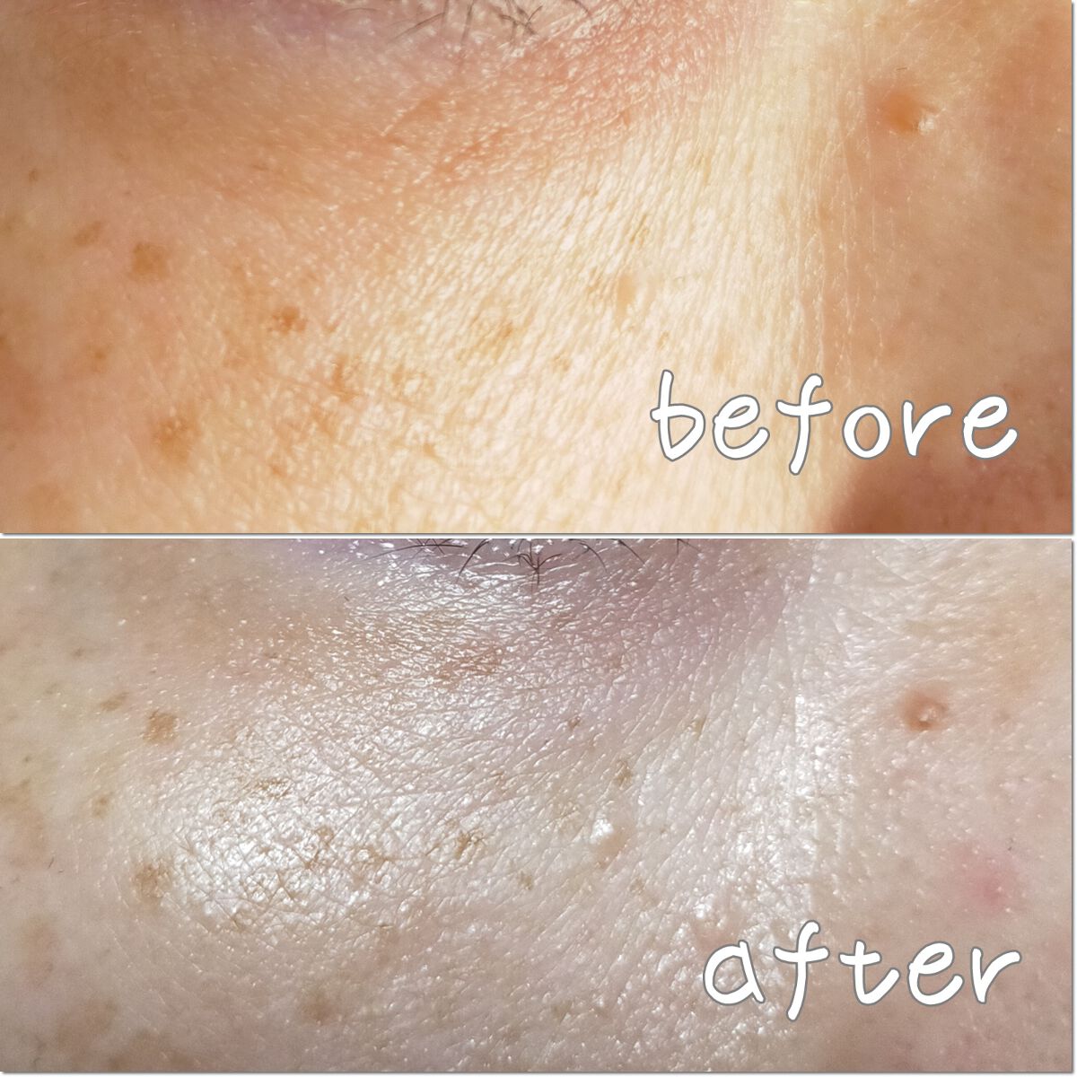 アイクリーム/Homeo Beau/アイケア・アイクリームを使ったクチコミ（2枚目）