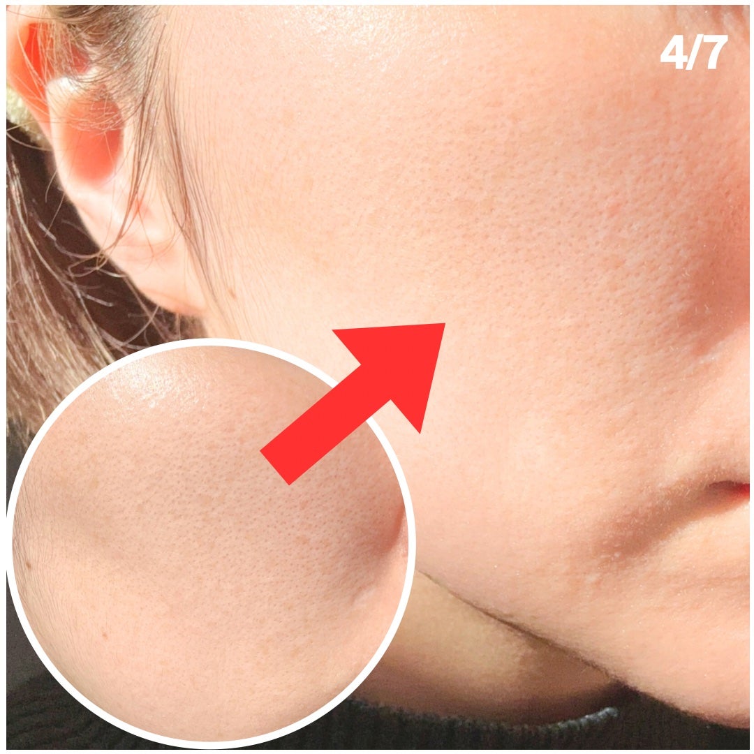 ガムシートマスクドクダミステッカー/Abib /シートマスク・パックを使ったクチコミ(4枚目)