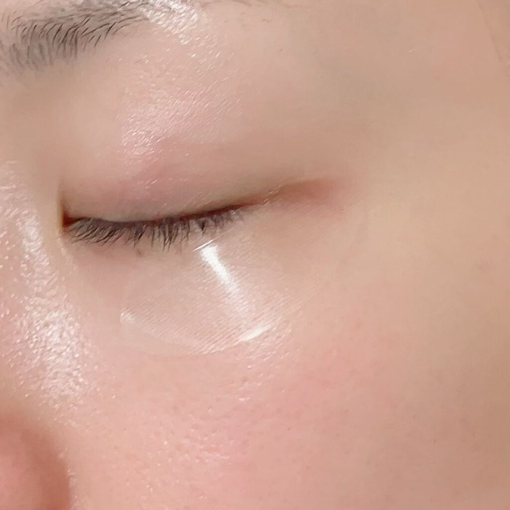 ネオベーシックVCフィルマイクロパッチ/NEO BASIC/アイケア・アイクリームを使ったクチコミ（3枚目）