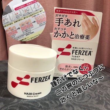 やわらか素肌クリームU (第3医薬品) 145g/メンソレータム/その他を使ったクチコミ（2枚目）