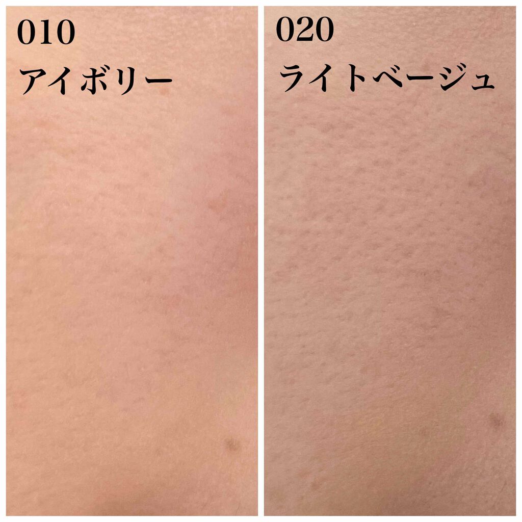 光美容器KE-NON(ケノン)/エムテック/家庭用脱毛器を使ったクチコミ(3枚目)