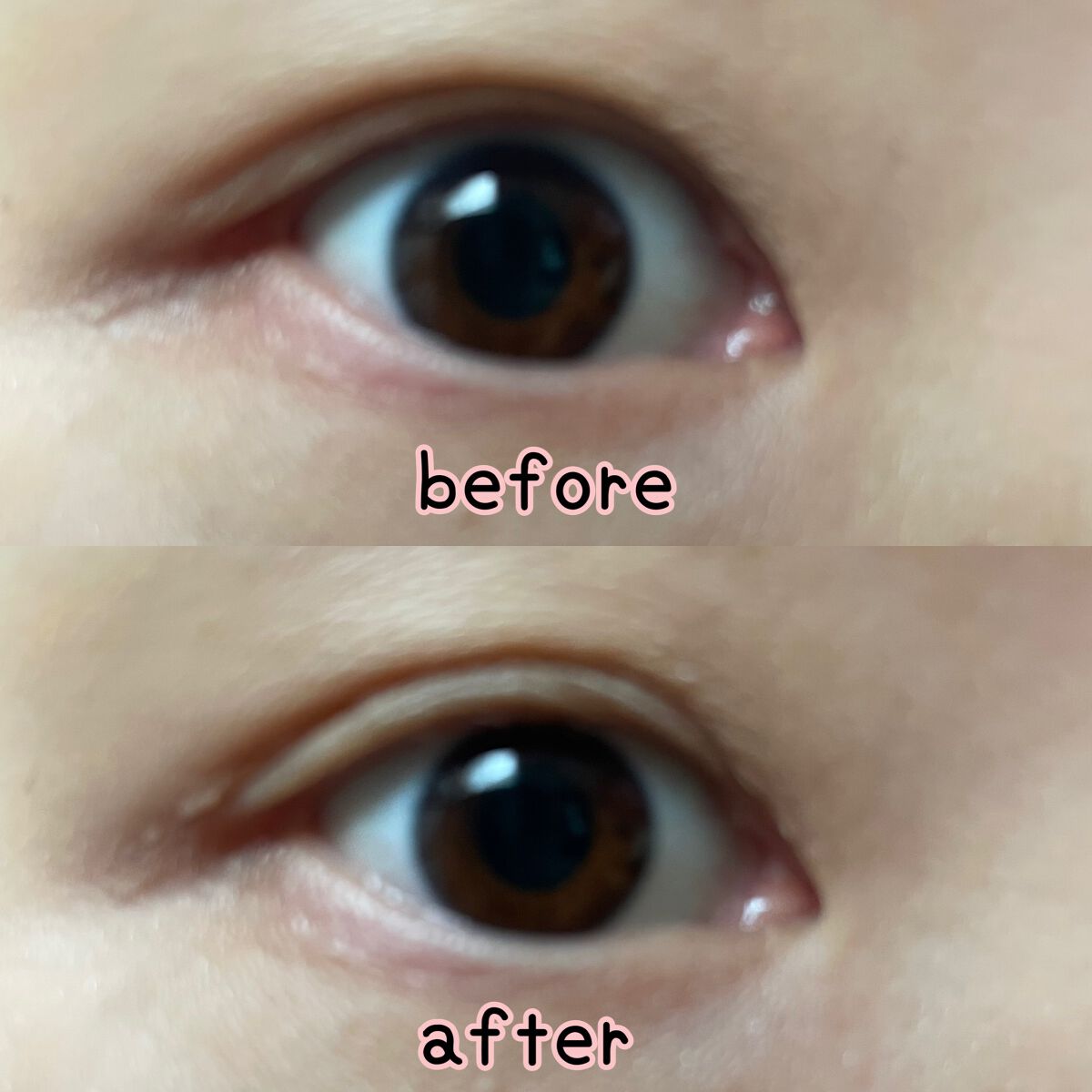 マイクロファイバー /ビー・エヌ/二重まぶた用アイテムを使ったクチコミ(3枚目)