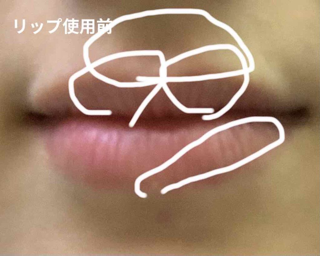 DHC 薬用リップクリーム/DHC/リップクリームを使ったクチコミ（1枚目）