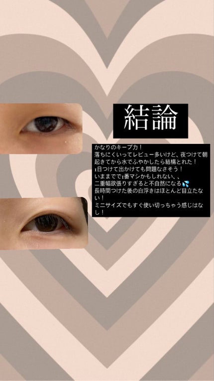 アイビューティー フィクサー WP/アストレア ヴィルゴ/二重まぶた用アイテムを使ったクチコミ(2枚目)