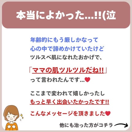 あなたの肌に合ったスキンケア💐コーくん先生 on LIPS 「【知らないとまじで損】エグいほど毛穴の開きが消える裏技..あな..」(7枚目)