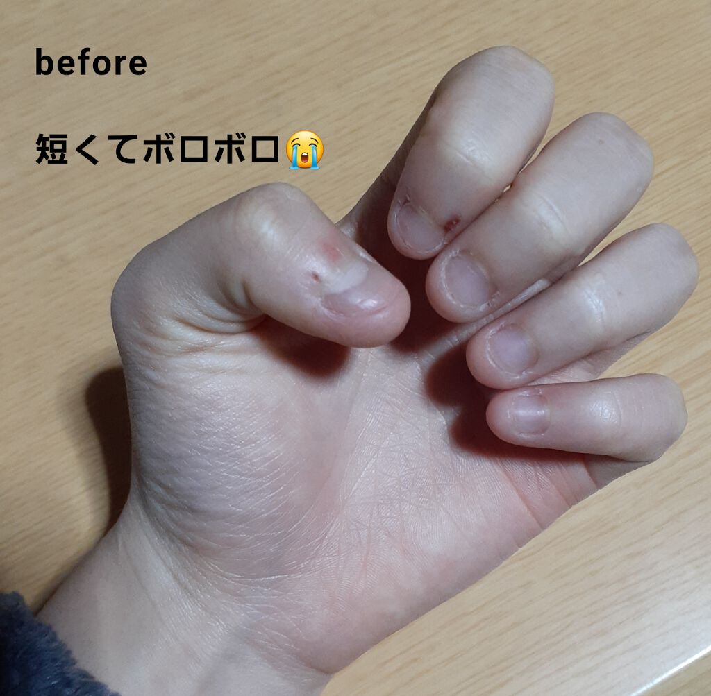 爪強化ベースコート/DAISO/ネイルベースコートを使ったクチコミ（2枚目）