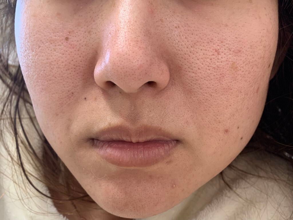 高品位「スクワラン」/HABA/フェイスオイルを使ったクチコミ(2枚目)