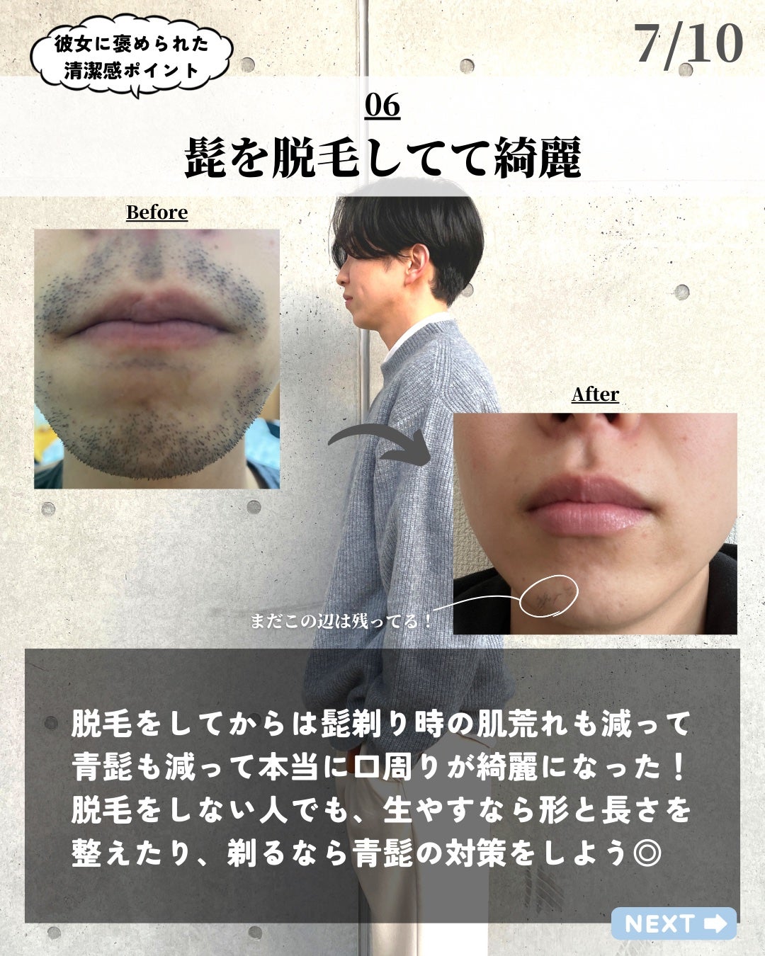 ほづ|メンズ美容で清潔感を上げる on LIPS 「あなたが清潔感をあげたい目的はなんですか??僕の最初の動機は彼..」(7枚目)