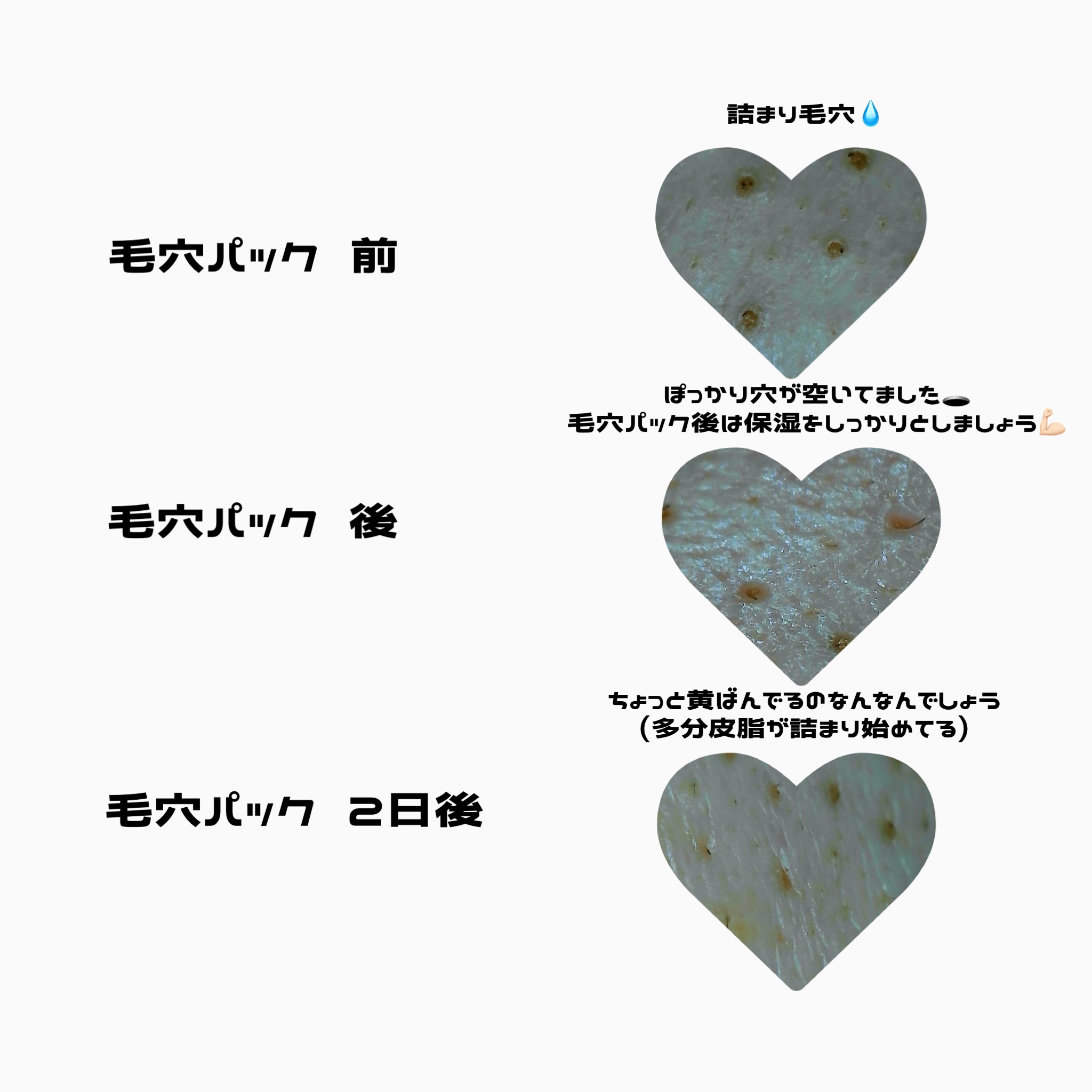 毛穴すっきりパック 鼻用 白色タイプ/ビオレ/その他スキンケアを使ったクチコミ（3枚目）