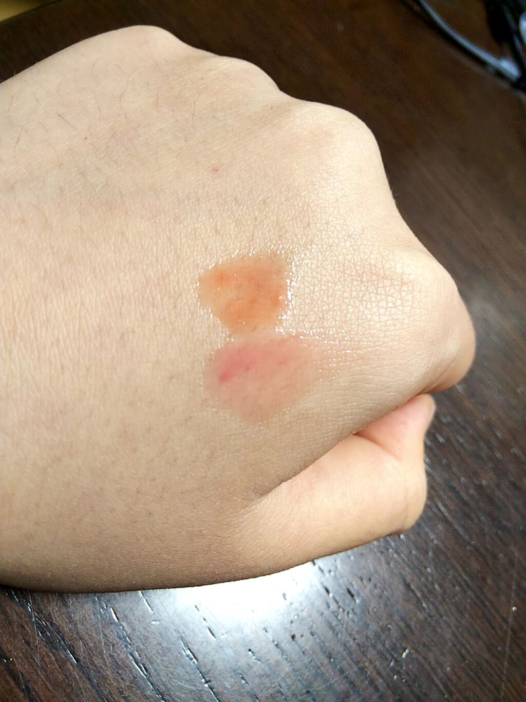 38°C / 99°F リップトリートメント (リップ美容液)/UZU BY FLOWFUSHI/リップケアを使ったクチコミ(2枚目)