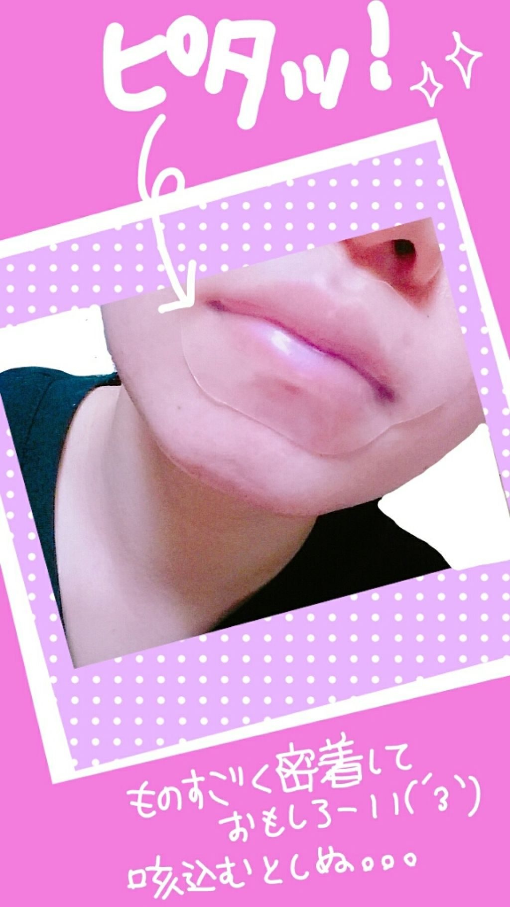 リップパック /CHOOSY/リップマスクを使ったクチコミ(2枚目)