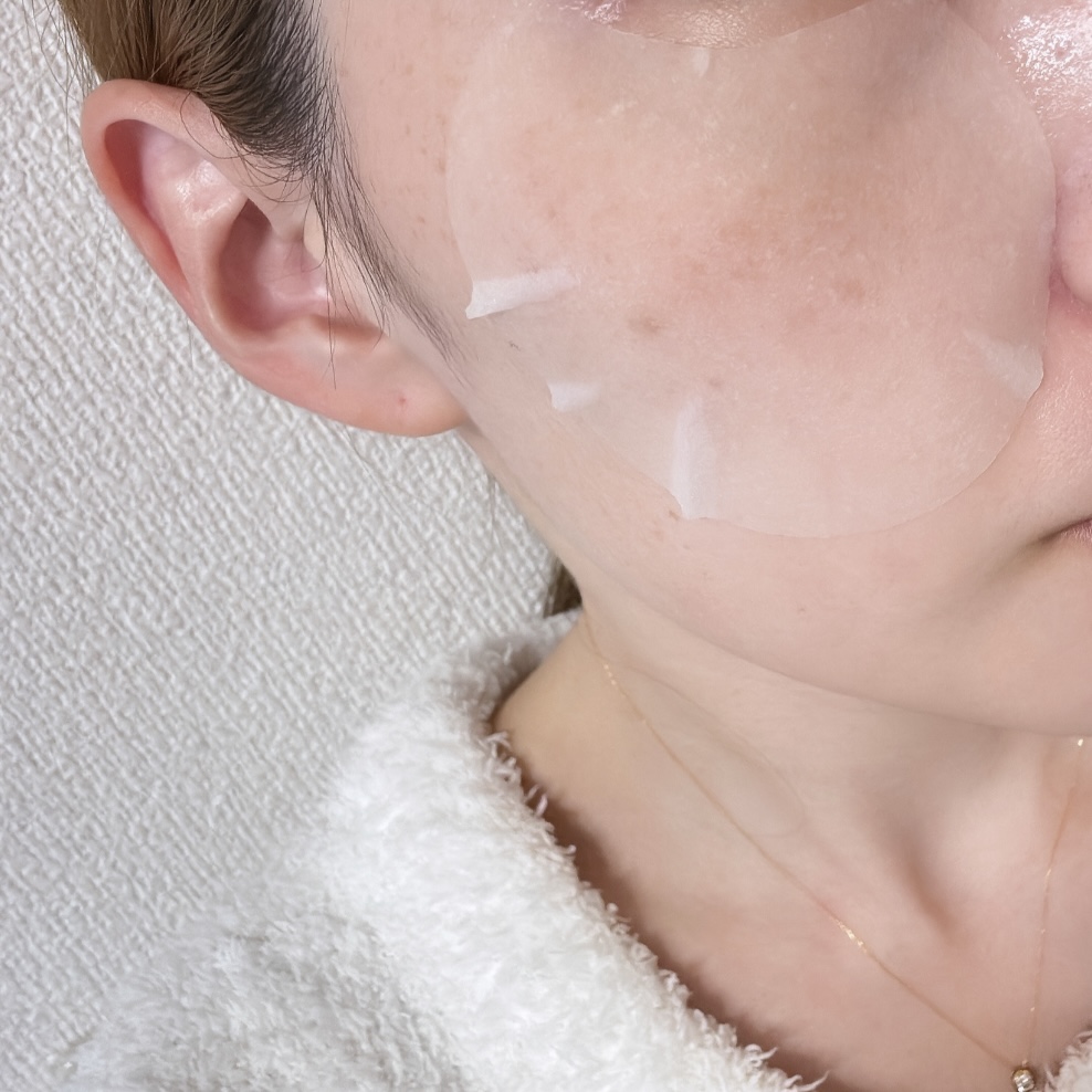 センテラ クイックカーミングパッド/SKIN1004/トナーパッドを使ったクチコミ（2枚目）