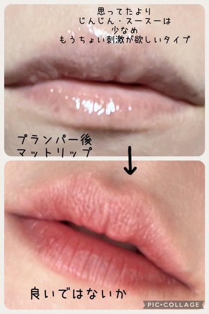 エッセンス リッププランパー/Visée/リッププランパーを使ったクチコミ(5枚目)