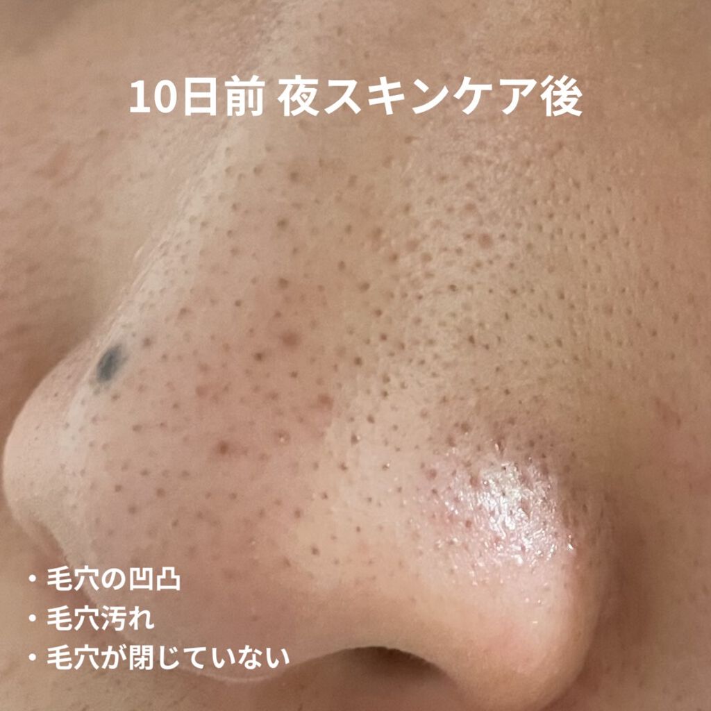 ウオーター/アベンヌ/ミスト状化粧水を使ったクチコミ（2枚目）