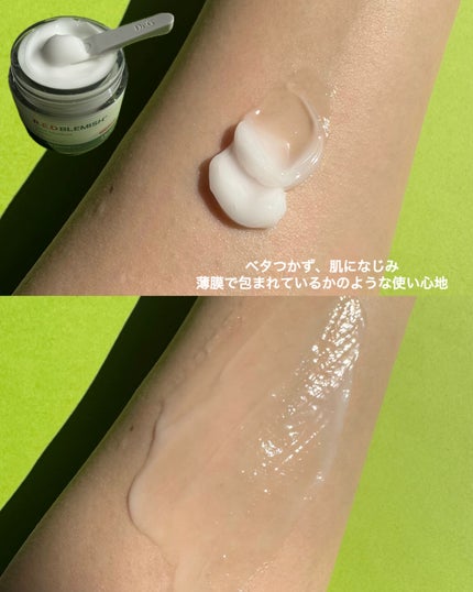 レッドブレミッシュ クリアモイスチャークリーム/Dr.G/フェイスクリームを使ったクチコミ(4枚目)