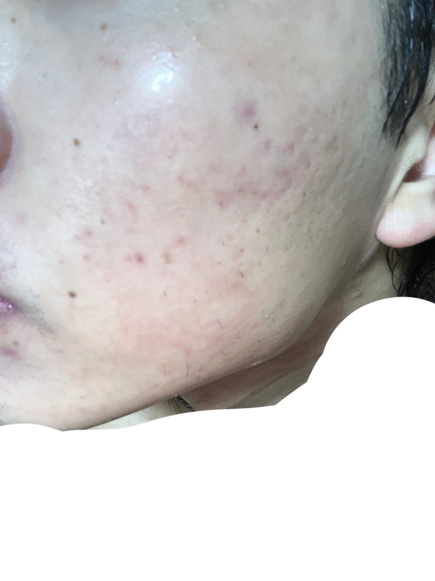 ロゼット洗顔パスタ アクネクリア/ロゼット/洗顔フォームを使ったクチコミ(3枚目)