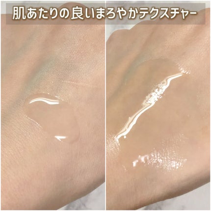 オイデルミン エッセンスローション/SHISEIDO/化粧水を使ったクチコミ(5枚目)