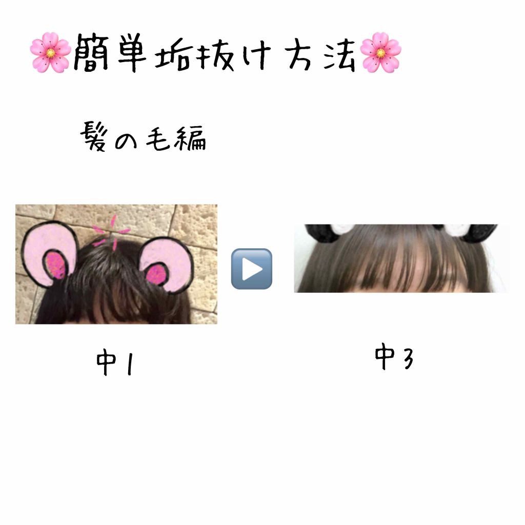 ððð¢ on LIPS ãããã«ã¡ã¯ðð»ä»åã¯å¢æãæ¹æ³å髪線ã§ãåçãèŠãŠã®éãç§ã¯æ..ãïŒ1æç®ïŒ