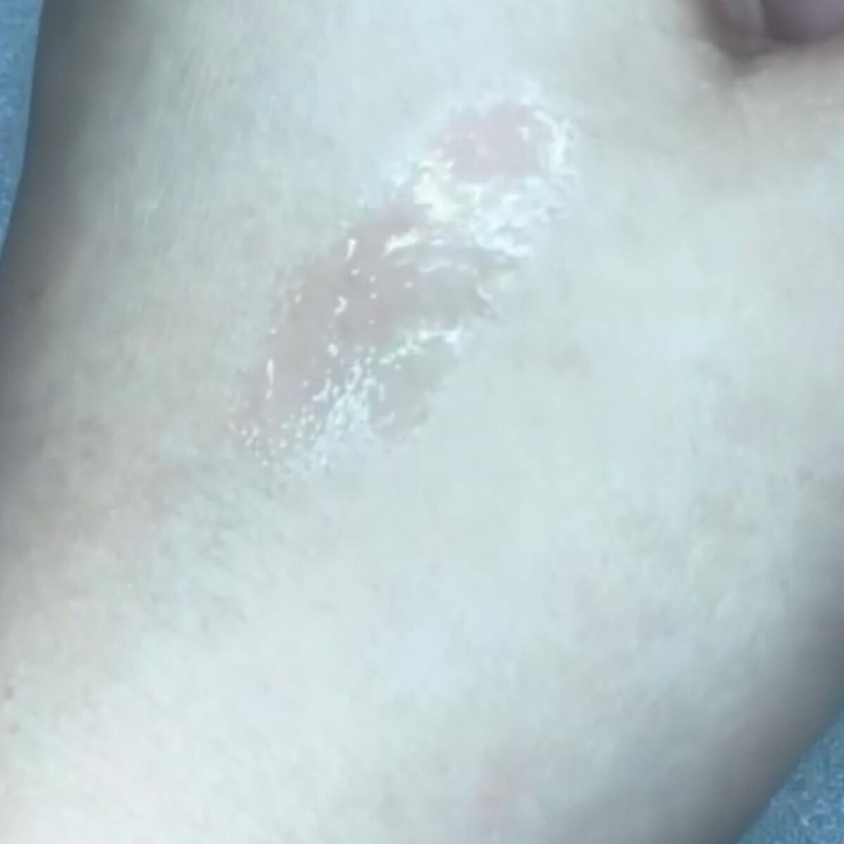 ayayan_yan on LIPS ãðãããŒãããã¥ã©ããð现èããæ¬æ¥ã®çŸãããåãæ»ããã幹现..ãïŒ3æç®ïŒ