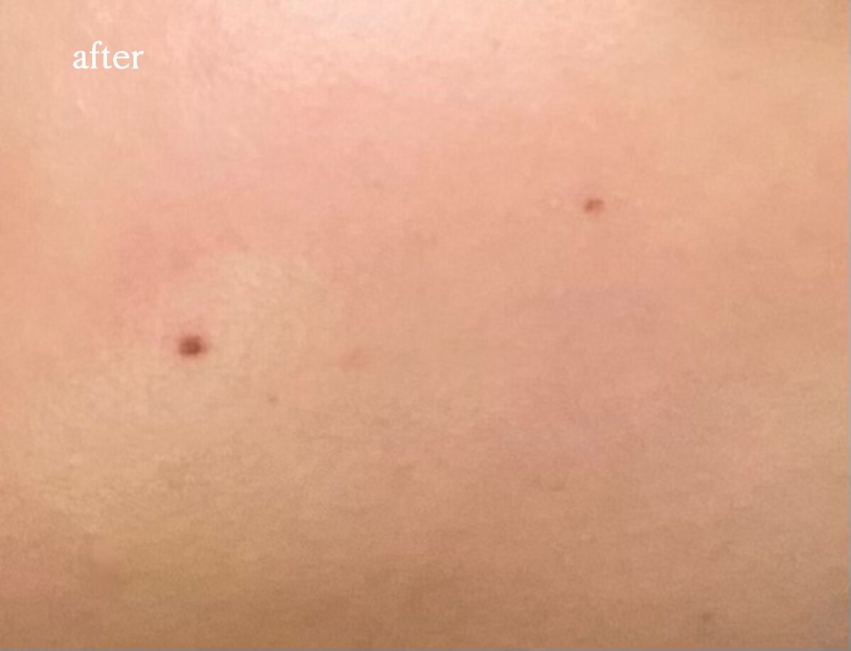 UVカット デイバリアUVローション/キュレル/日焼け止め・UVケアを使ったクチコミ(5枚目)