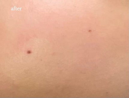 UVカット デイバリアUVローション/キュレル/日焼け止め・UVケアを使ったクチコミ(5枚目)