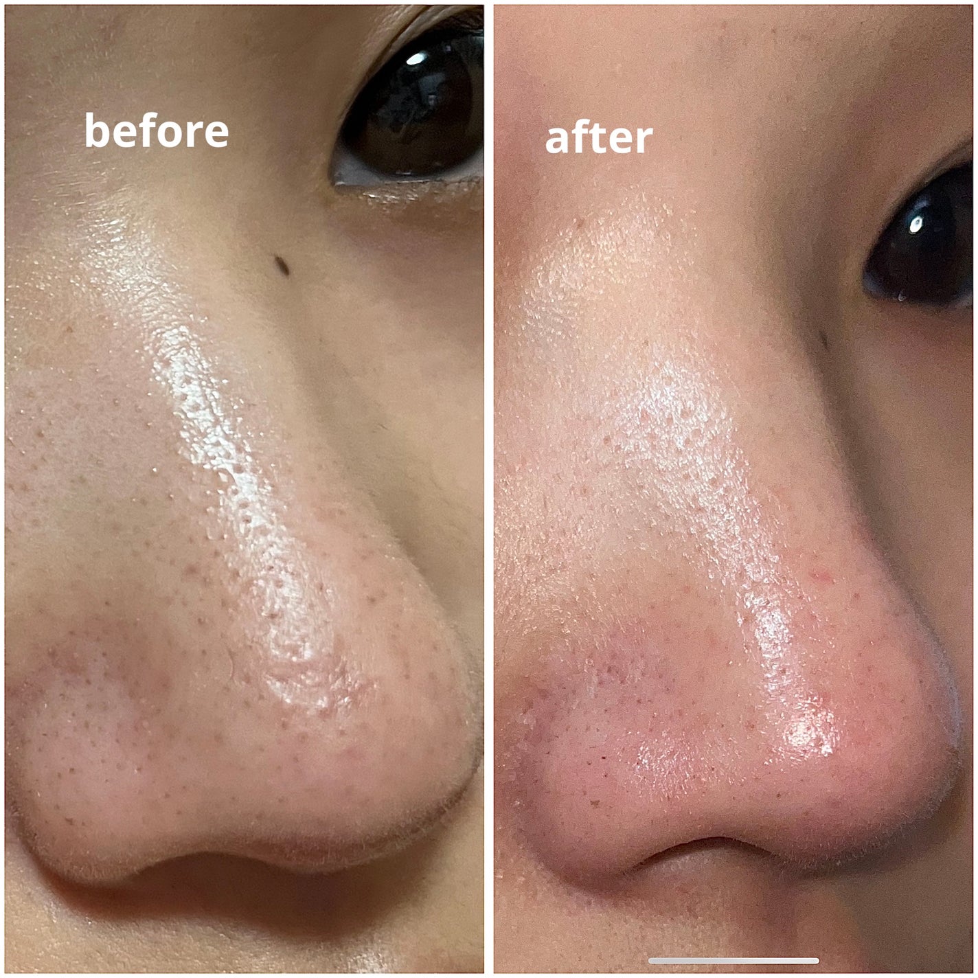 リンクル化粧水 N/なめらか本舗/化粧水を使ったクチコミ(2枚目)