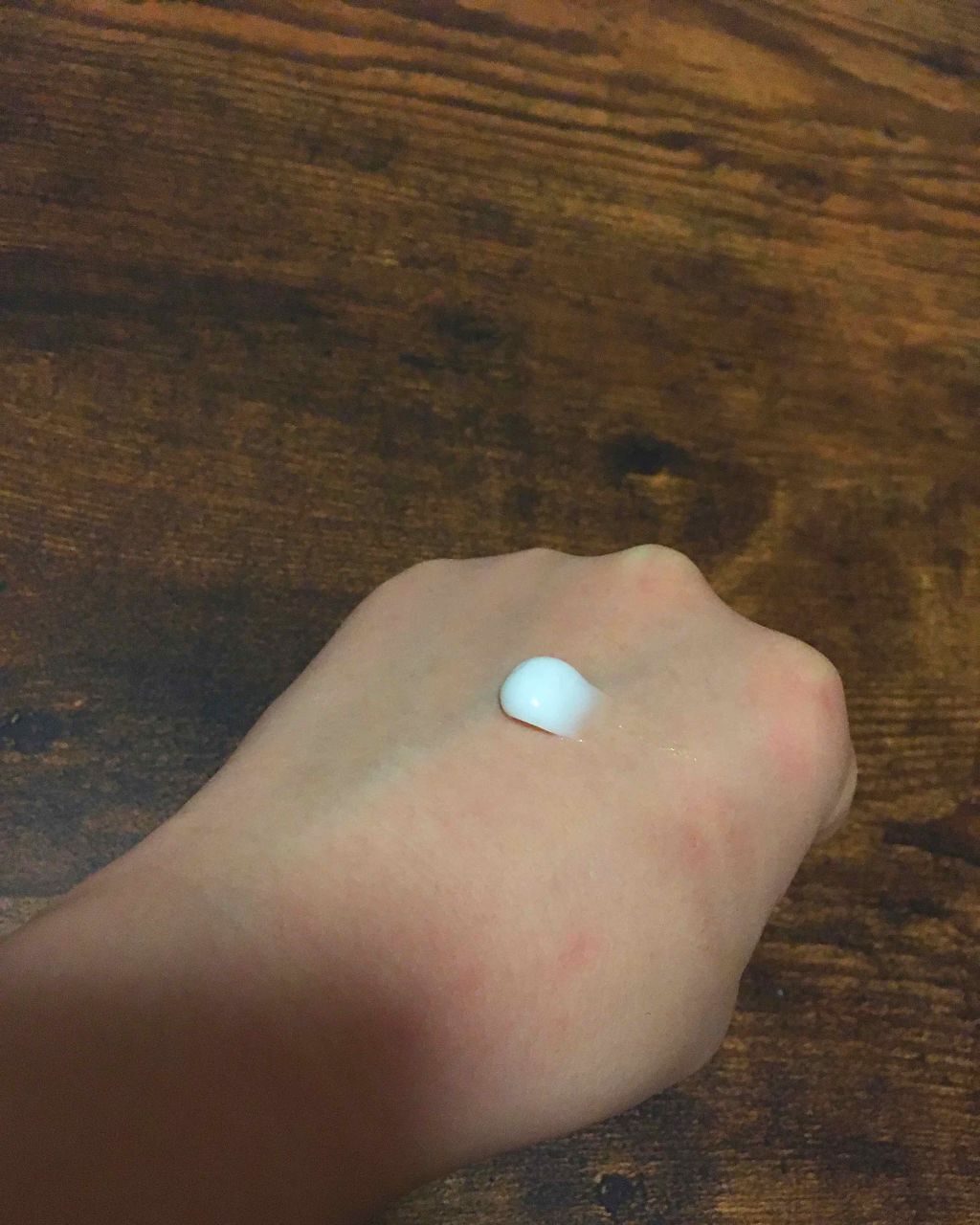 アポスティークリーム(医薬品)/アポスティー/その他を使ったクチコミ(3枚目)