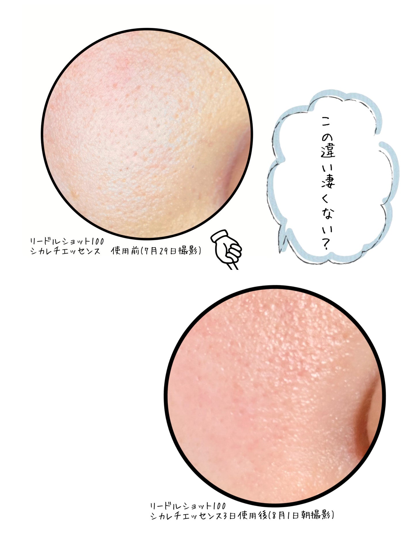 リードルショット100/VT/美容液を使ったクチコミ(5枚目)