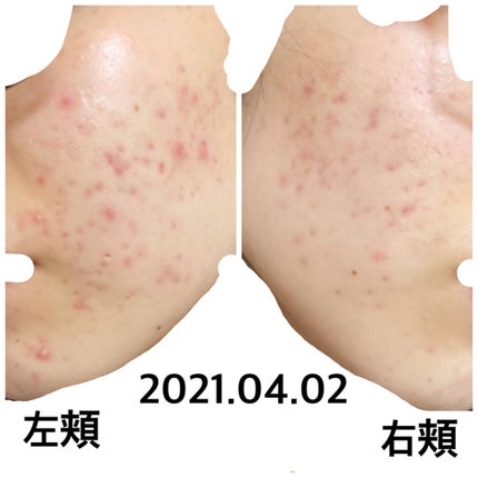 乳液・敏感肌用・高保湿タイプ/無印良品/乳液を使ったクチコミ(1枚目)