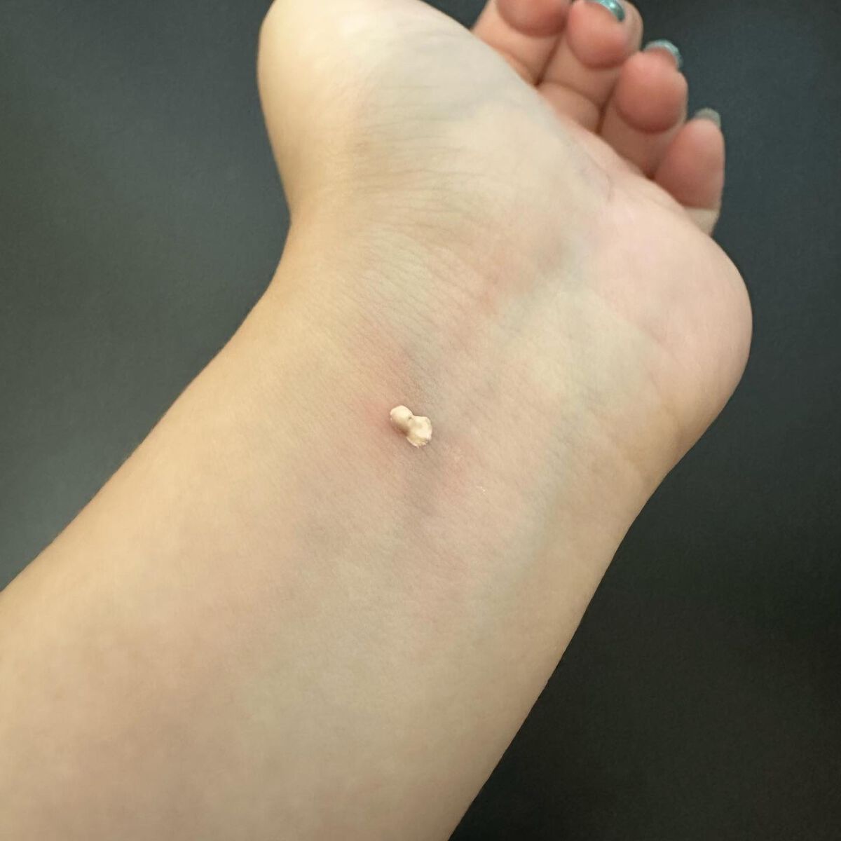 ドラマティックコンシーラー ライト/マキアージュ/クリームコンシーラーを使ったクチコミ（2枚目）