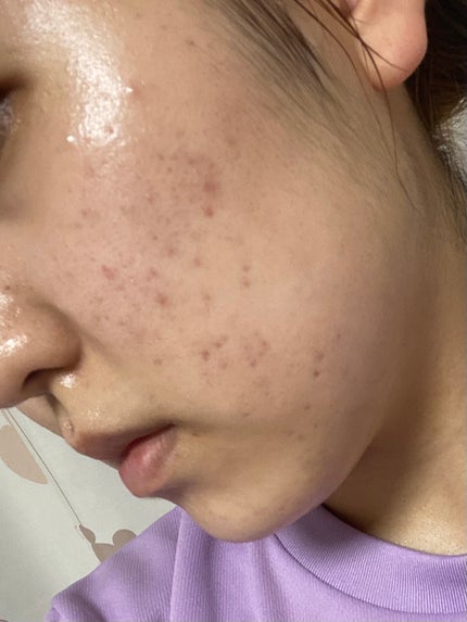 ããð± on LIPS ããã£ãšæ°ã«ãªã£ãŠããã·ã«ã¬ãã賌å
¥ããã®ã§ã2ã¶æã»ã©äœ¿çšãç¶..ãïŒ6æç®ïŒ