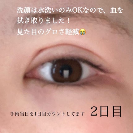 すぅ on LIPS 「私は、4年前から少しずつプチ整形も含めて、整形しています!20..」(5枚目)