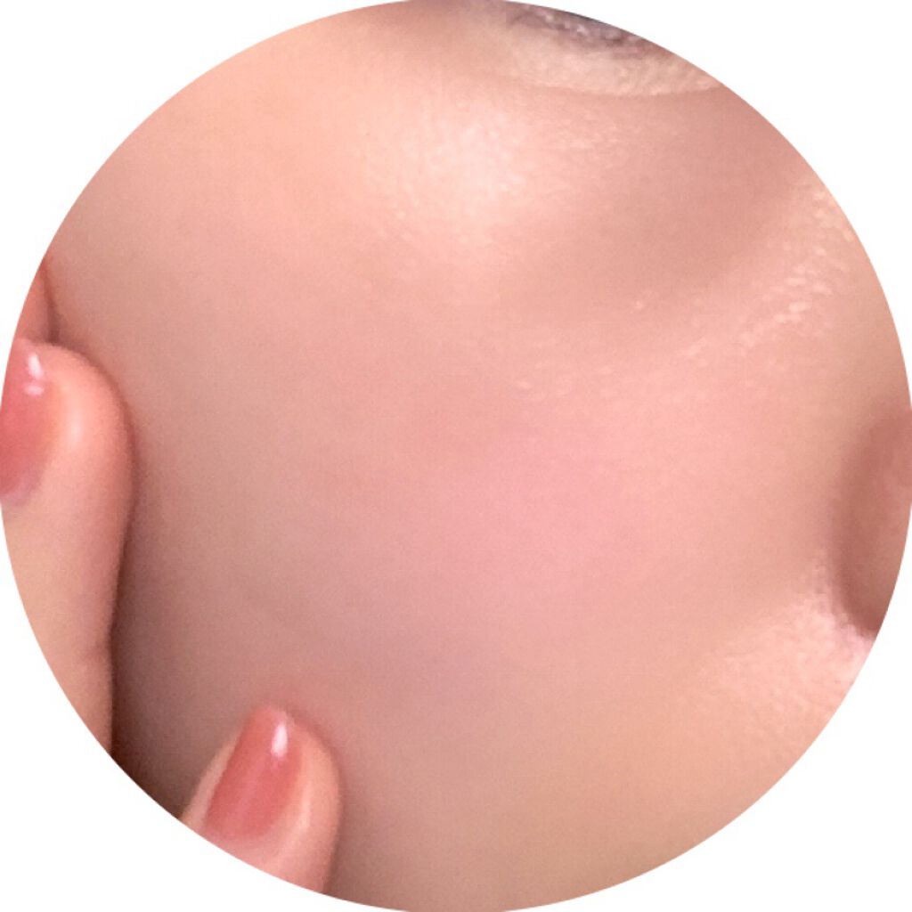 モイストバランス ローション/ACSEINE/化粧水を使ったクチコミ(5枚目)