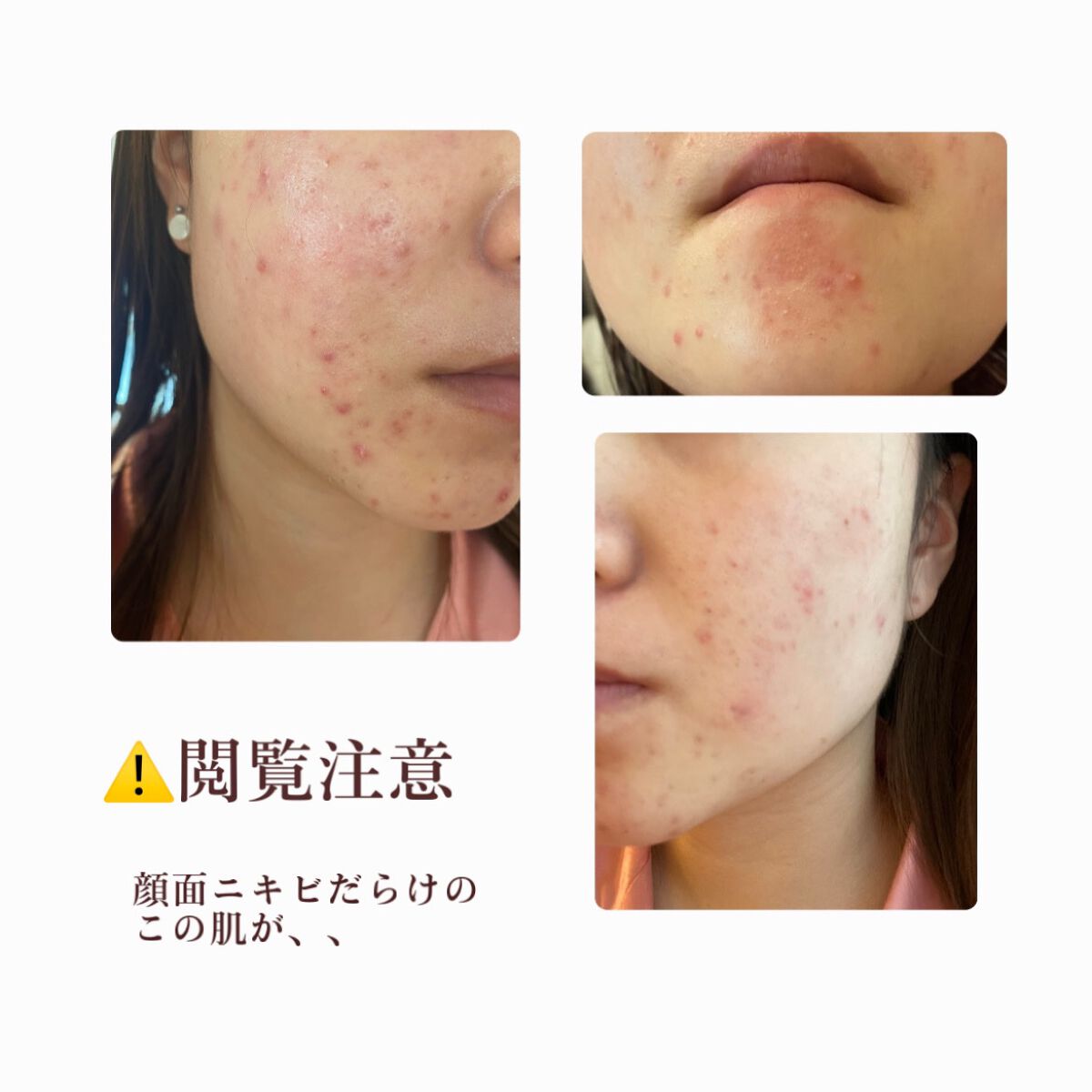 ビフィダシカハーブトナー/manyo/化粧水を使ったクチコミ（2枚目）