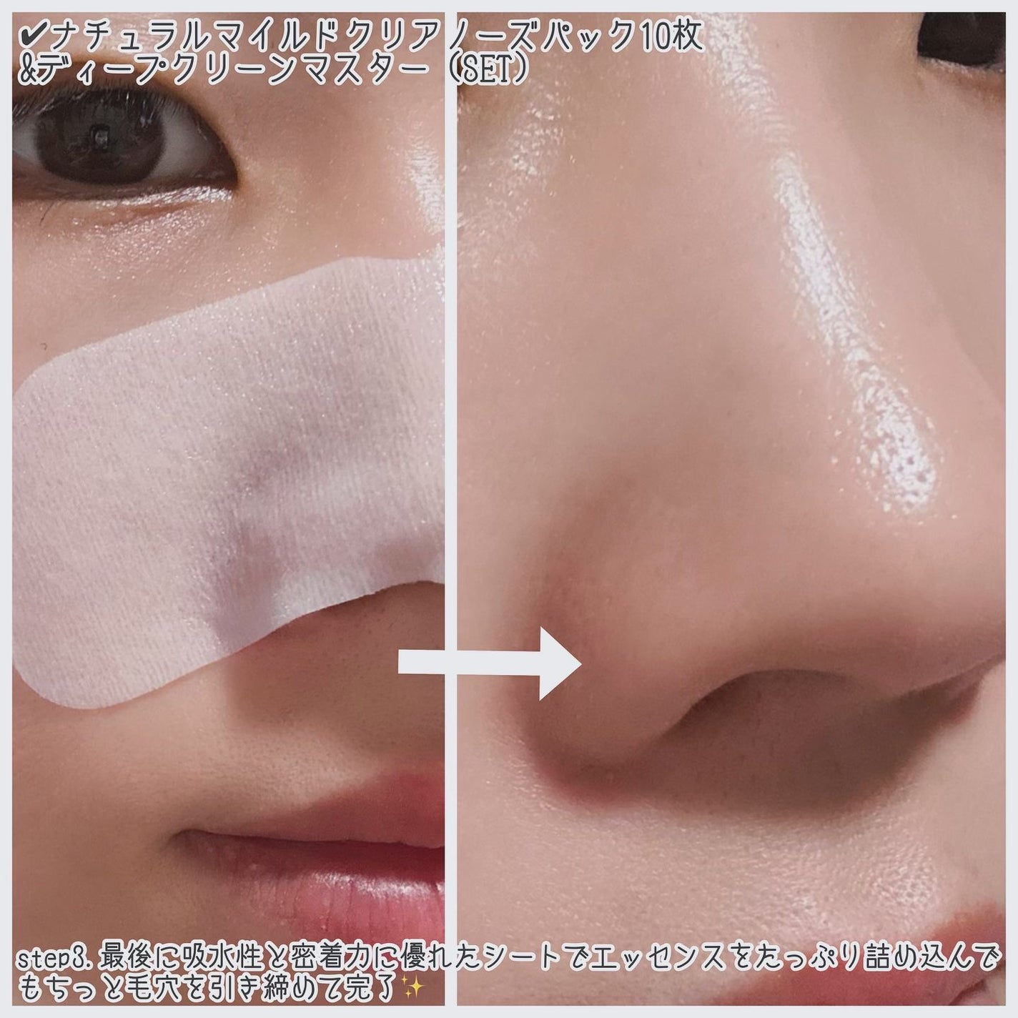 ナチュラルマイルドクリアノーズパック/ilso/シートマスク・パックを使ったクチコミ(5枚目)