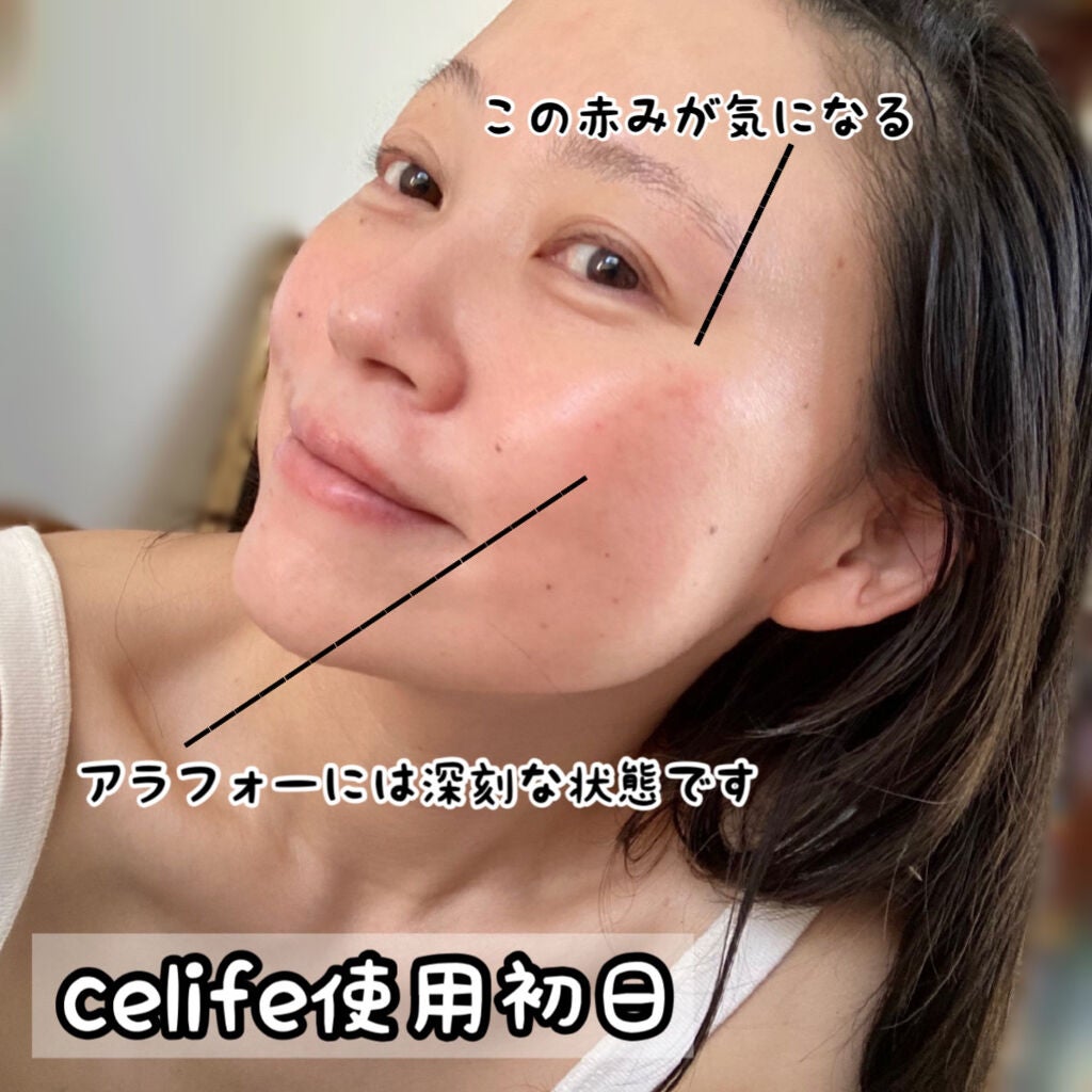 フラーレン配合美容液 フラーレン20/Celife/美容液を使ったクチコミ(8枚目)