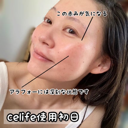 フラーレン配合美容液 フラーレン20/Celife/美容液を使ったクチコミ(8枚目)