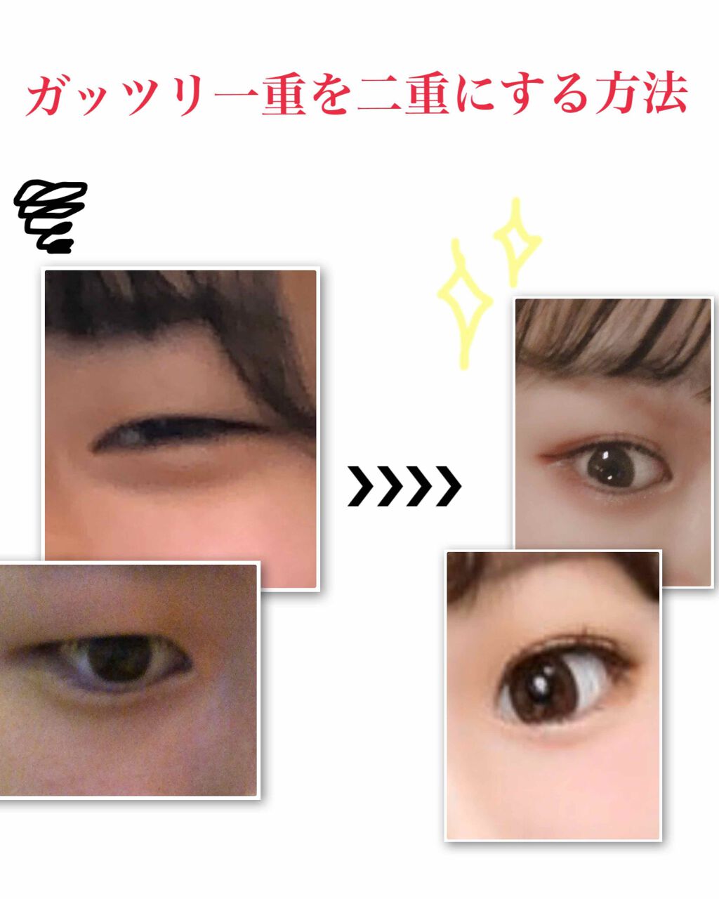 のびーるアイテープ（絆創膏タイプ、レギュラー）/DAISO/二重まぶた用アイテムを使ったクチコミ（1枚目）