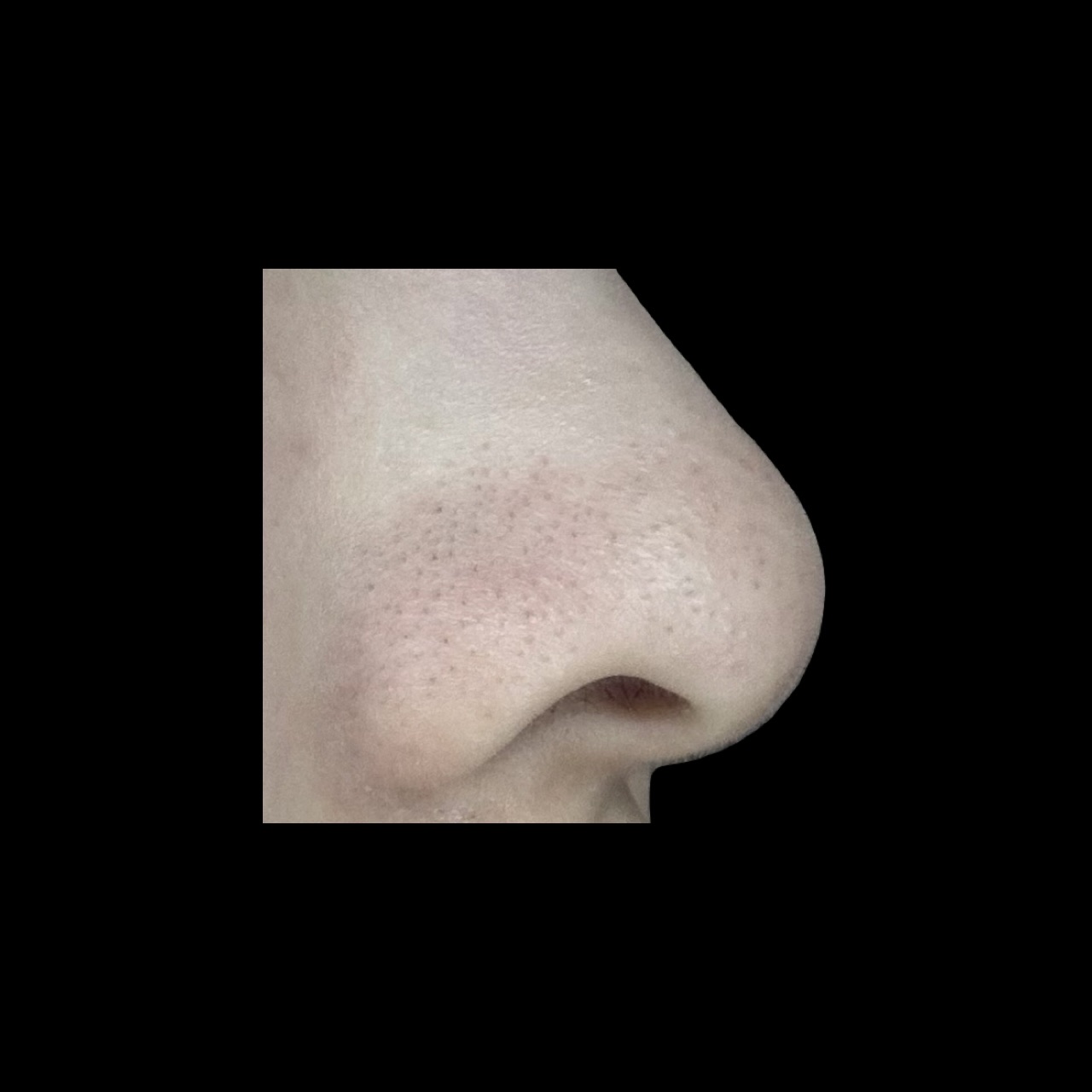 デュオ ザ クレンジングバーム ブラックリペア /DUO/クレンジングバームを使ったクチコミ（3枚目）