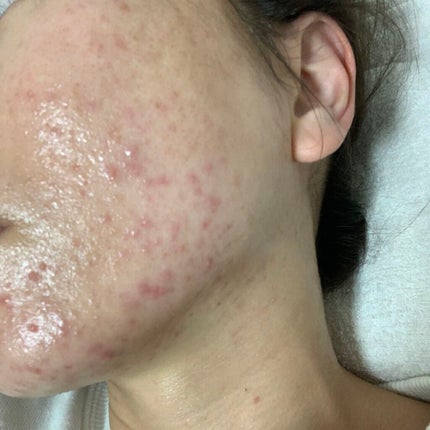 ルナフェミン(医薬品)/ロート製薬/その他を使ったクチコミ(4枚目)