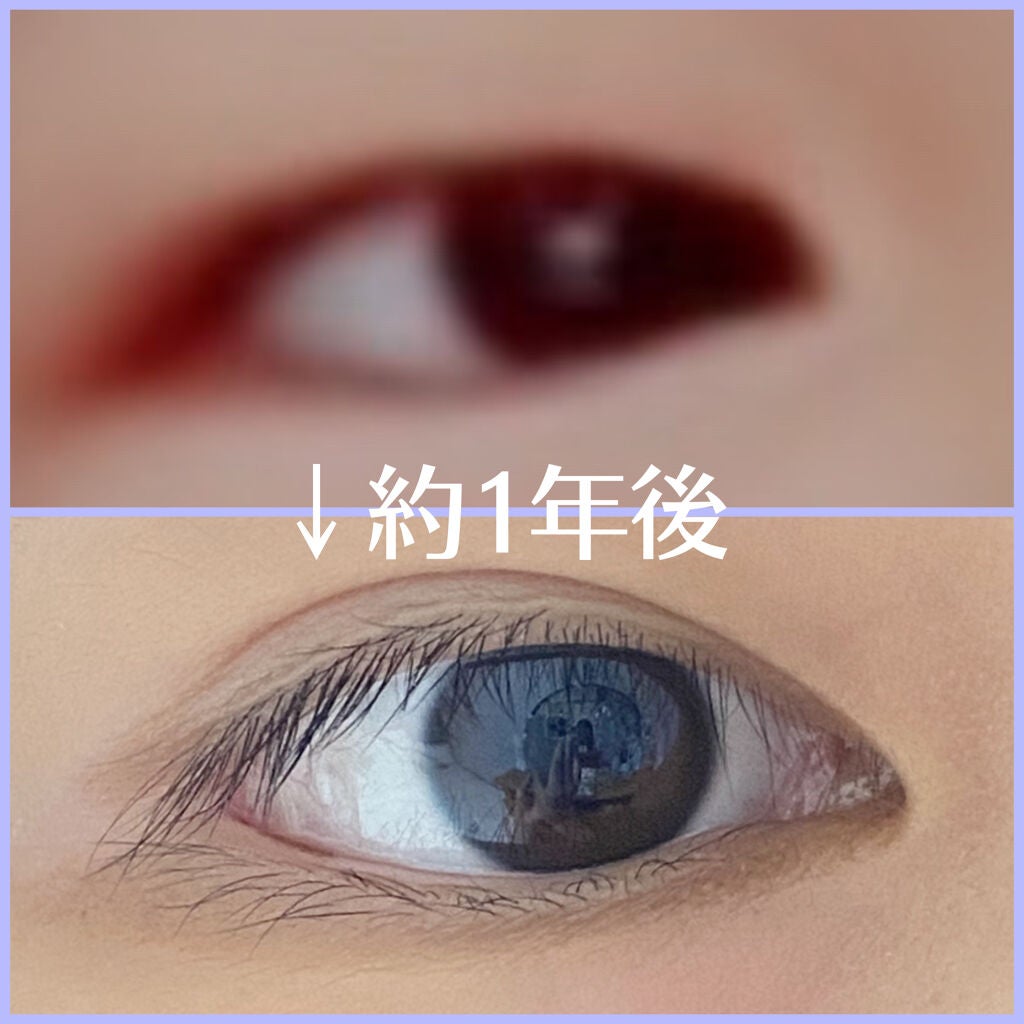 メ タ モ ン on LIPS 「写真のように二重になった方法を紹介します😌~用意する物~・ダイ..」(1枚目)