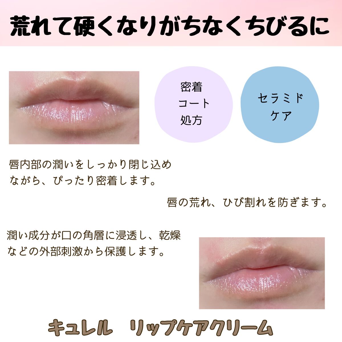 リップケア クリーム/キュレル/リップクリームを使ったクチコミ（3枚目）