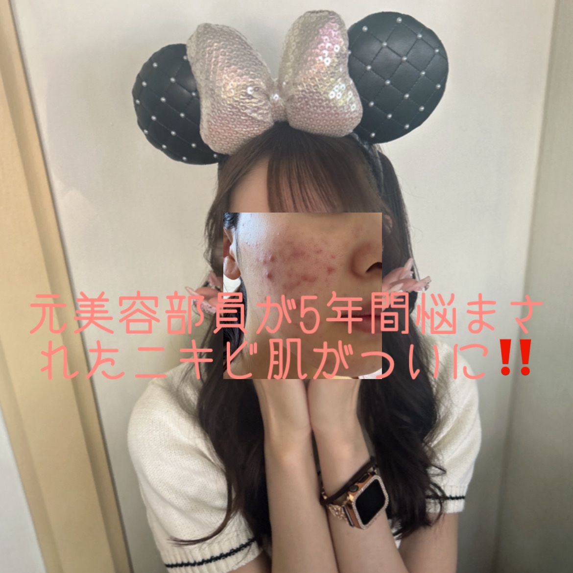 トリートメント クレンジング ミルク/COVERMARK/ミルククレンジングを使ったクチコミ（1枚目）