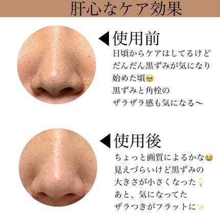 チョコブラ スペシャル毛穴ケアセット/Chocobra/スキンケアキットを使ったクチコミ(3枚目)