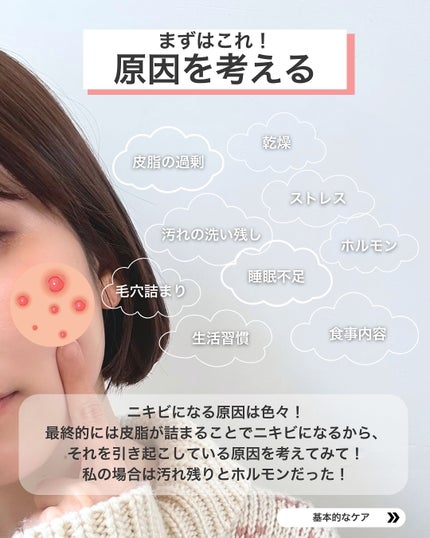 なぎ | スキンケア薬剤師 on LIPS 「◀︎ニキビ肌から毛穴レスになった薬剤師ニキビできたらこれやって..」(4枚目)