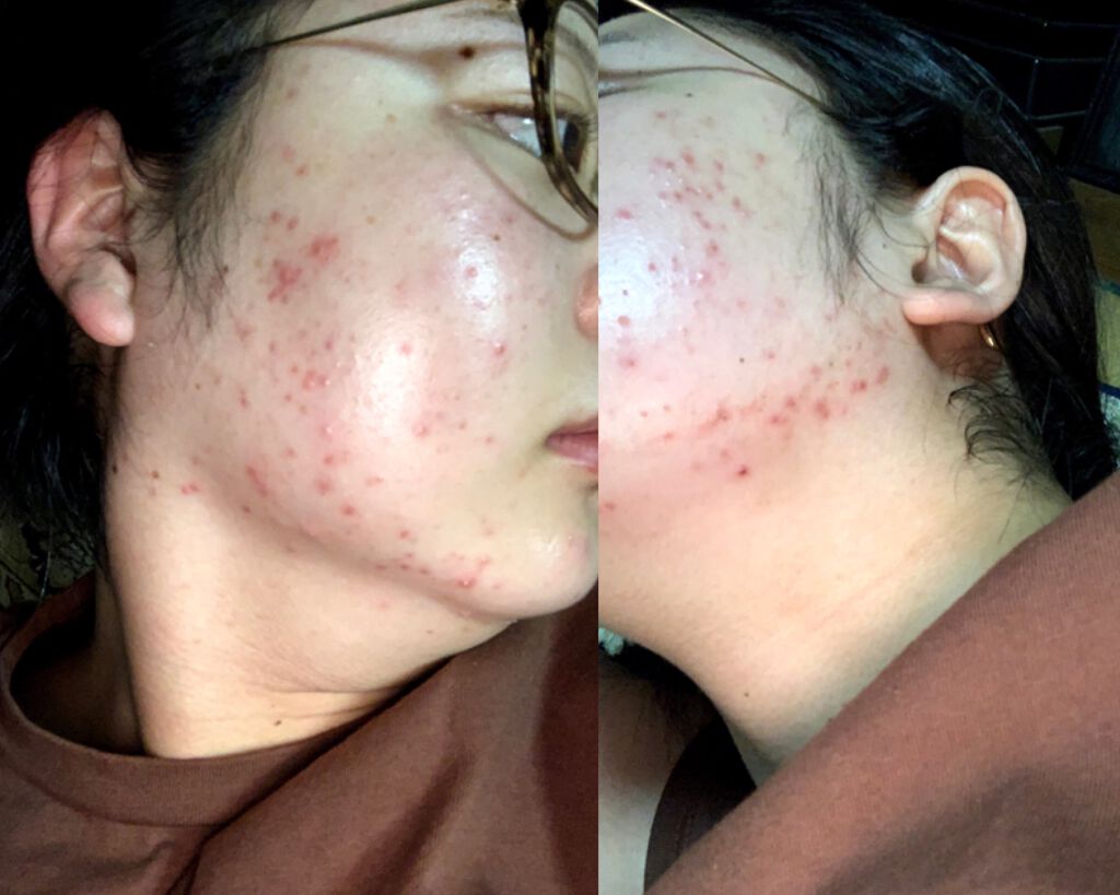 Cセラム/b.glen/美容液を使ったクチコミ（2枚目）