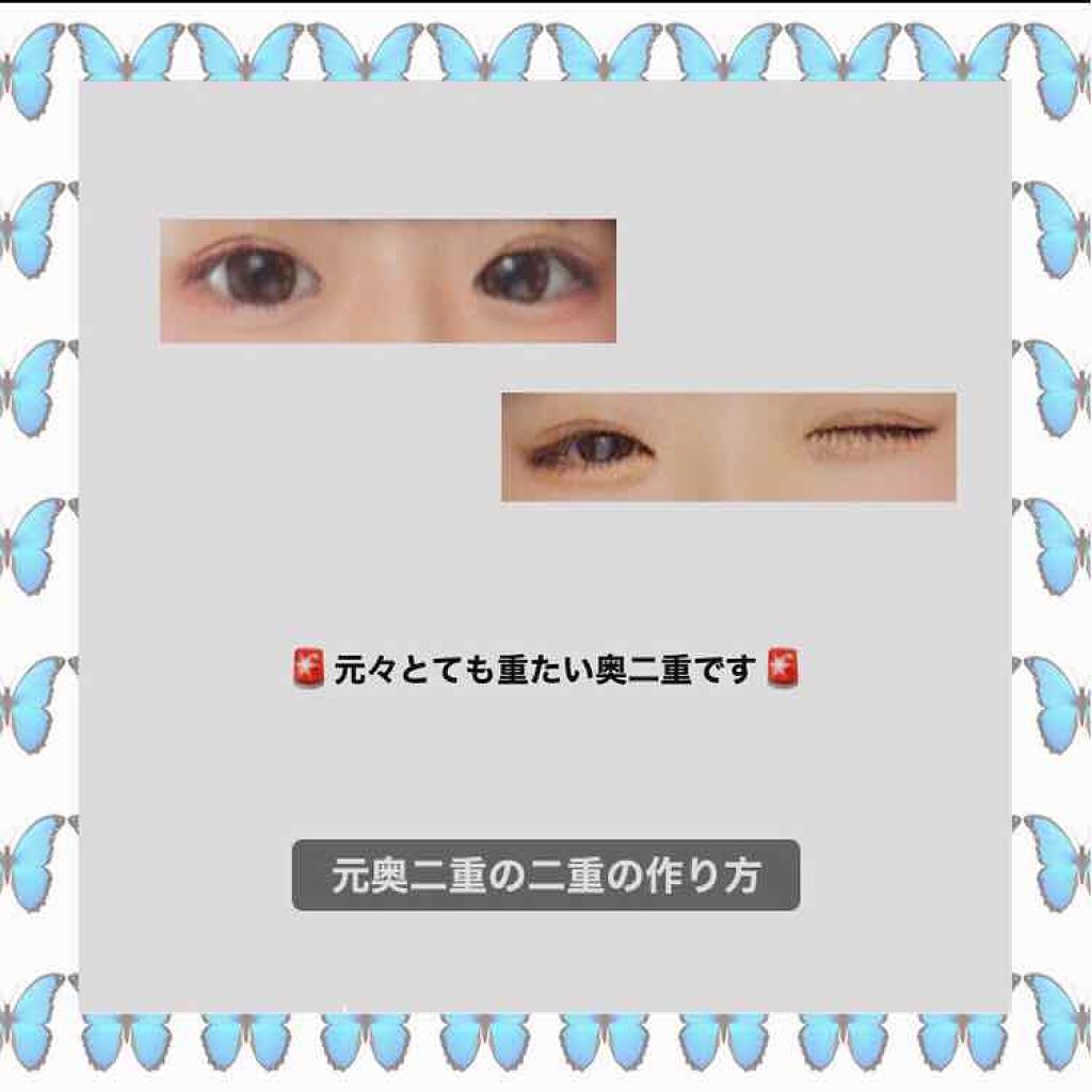 アイビューティー フィクサー WP/アストレア ヴィルゴ/二重まぶた用アイテムを使ったクチコミ（1枚目）